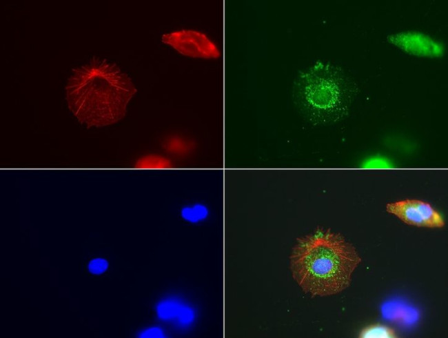 ABAT Antibody in Immunocytochemistry (ICC/IF)