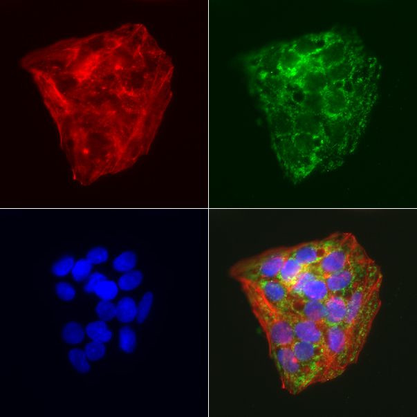 ABAT Antibody in Immunocytochemistry (ICC/IF)