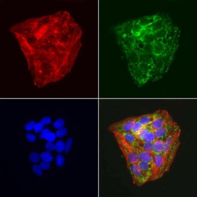 ABAT Antibody in Immunocytochemistry (ICC/IF)