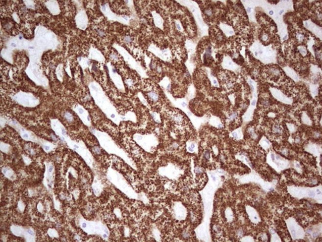 ABAT Antibody in Immunohistochemistry (Paraffin) (IHC (P))