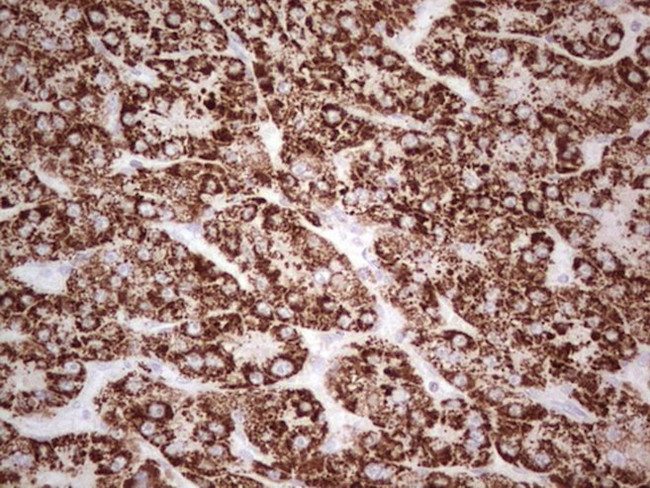 ABAT Antibody in Immunohistochemistry (Paraffin) (IHC (P))