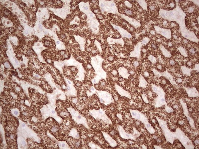 ABAT Antibody in Immunohistochemistry (Paraffin) (IHC (P))