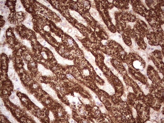 ABAT Antibody in Immunohistochemistry (Paraffin) (IHC (P))