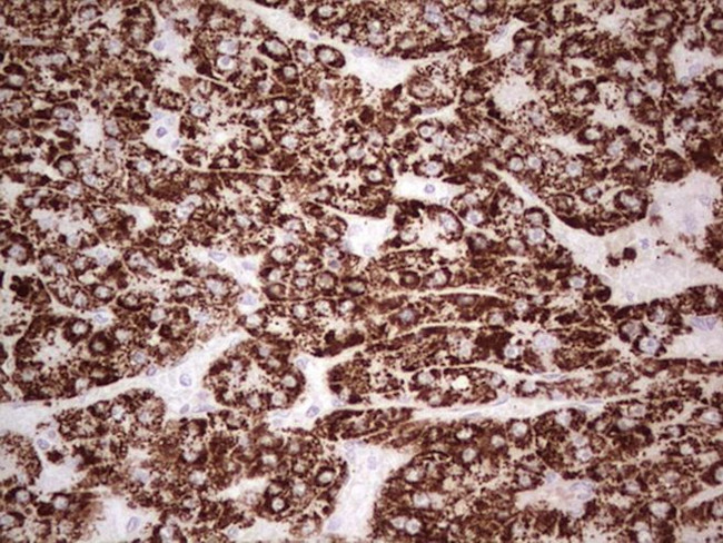 ABAT Antibody in Immunohistochemistry (Paraffin) (IHC (P))