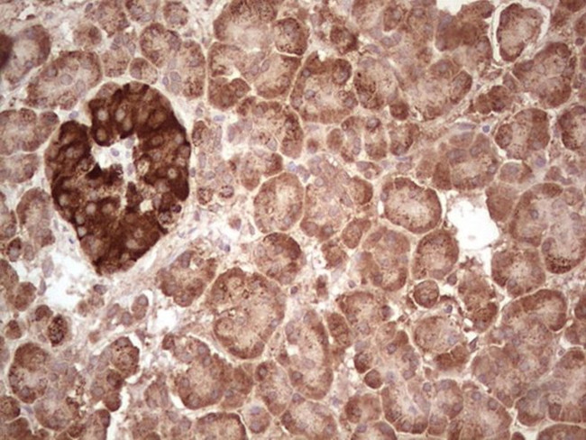 ABAT Antibody in Immunohistochemistry (Paraffin) (IHC (P))