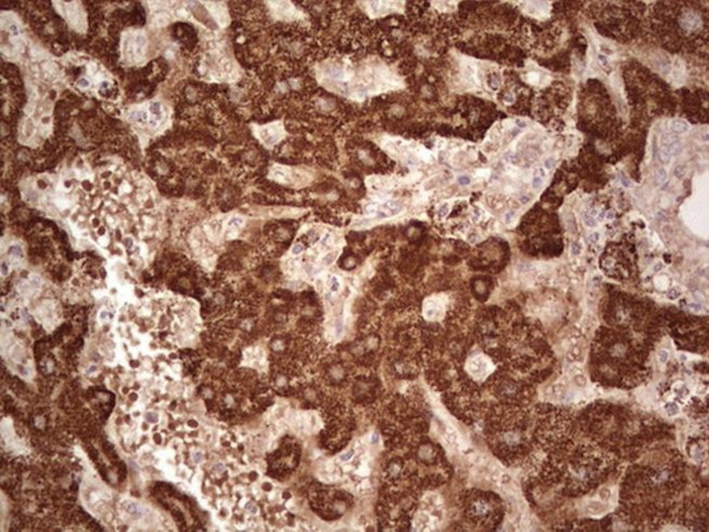 ABAT Antibody in Immunohistochemistry (Paraffin) (IHC (P))