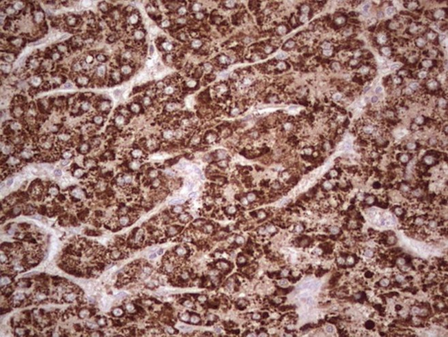 ABAT Antibody in Immunohistochemistry (Paraffin) (IHC (P))