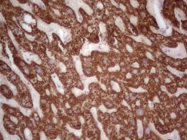 ABAT Antibody in Immunohistochemistry (Paraffin) (IHC (P))