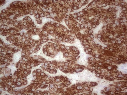 ABAT Antibody in Immunohistochemistry (Paraffin) (IHC (P))