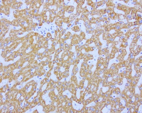 ABAT Antibody in Immunohistochemistry (Paraffin) (IHC (P))