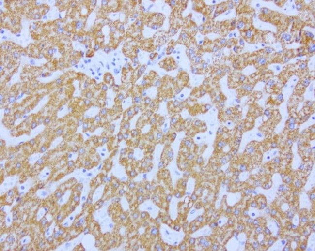 ABAT Antibody in Immunohistochemistry (Paraffin) (IHC (P))