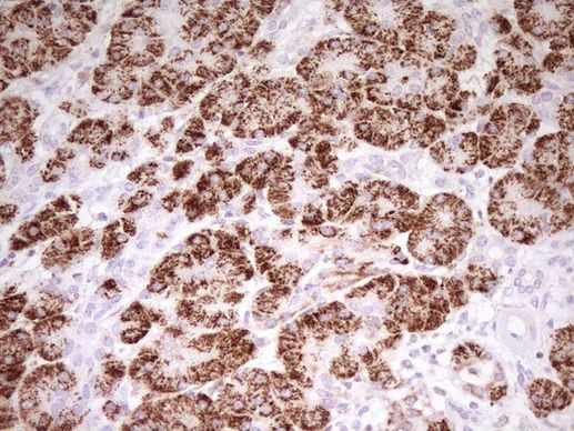 ABAT Antibody in Immunohistochemistry (Paraffin) (IHC (P))