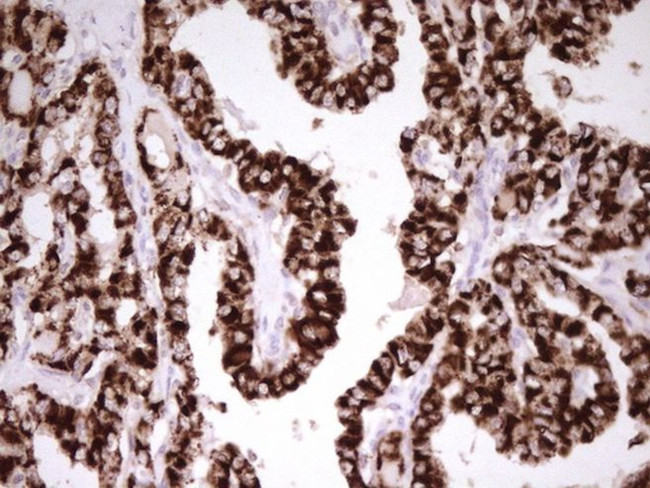 ABAT Antibody in Immunohistochemistry (Paraffin) (IHC (P))