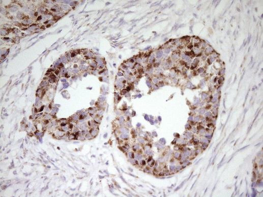 ABAT Antibody in Immunohistochemistry (Paraffin) (IHC (P))