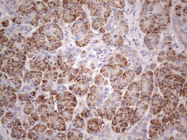 ABAT Antibody in Immunohistochemistry (Paraffin) (IHC (P))