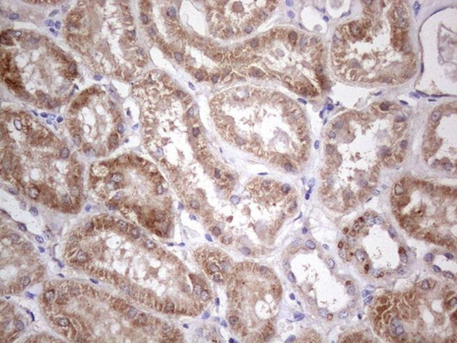 ABAT Antibody in Immunohistochemistry (Paraffin) (IHC (P))