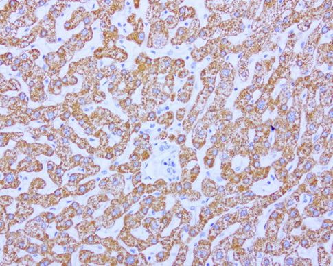 ABAT Antibody in Immunohistochemistry (Paraffin) (IHC (P))