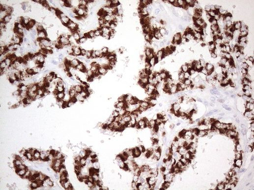 ABAT Antibody in Immunohistochemistry (Paraffin) (IHC (P))