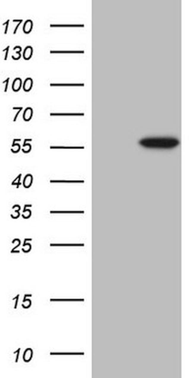 ABAT Antibody in Western Blot (WB)