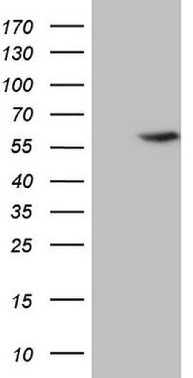 ABAT Antibody in Western Blot (WB)