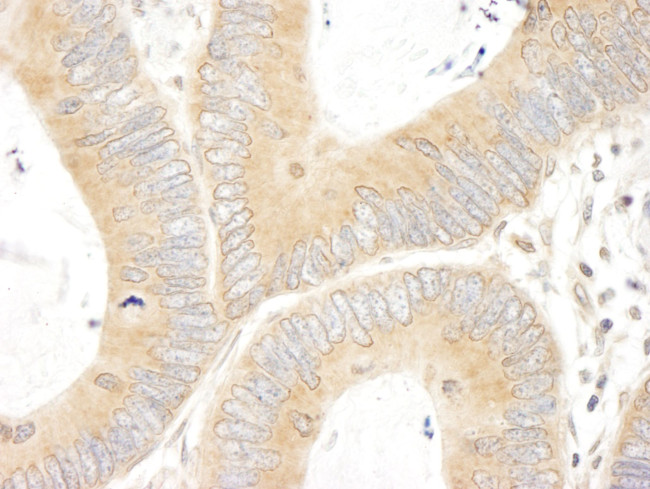 ABC50 Antibody in Immunohistochemistry (IHC)