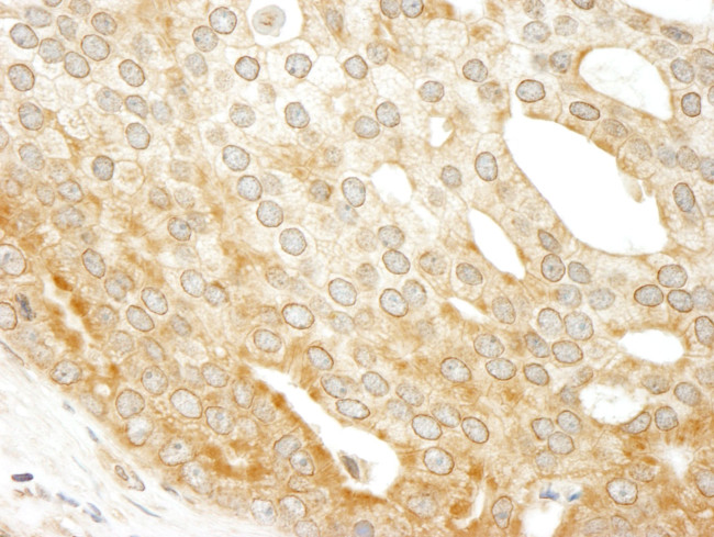 ABC50 Antibody in Immunohistochemistry (IHC)