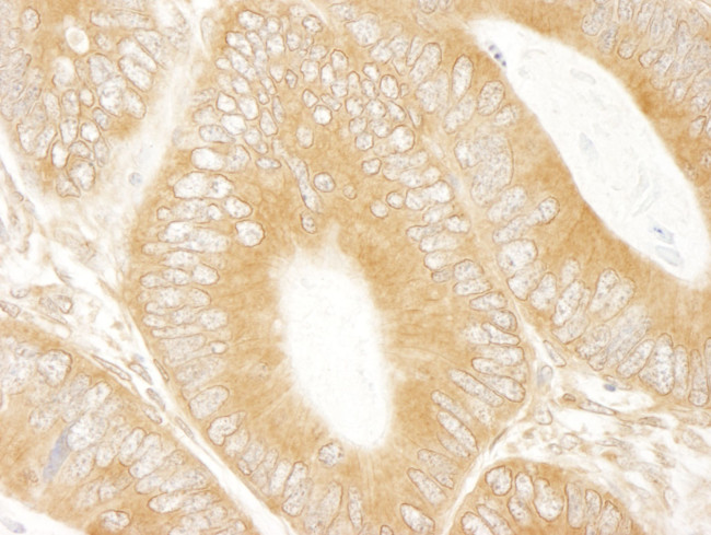 ABC50 Antibody in Immunohistochemistry (IHC)