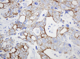 ABCB1 Antibody in Immunohistochemistry (Paraffin) (IHC (P))