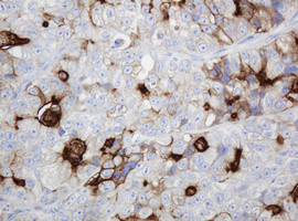 ABCB1 Antibody in Immunohistochemistry (Paraffin) (IHC (P))