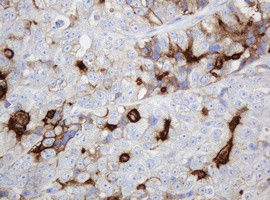 ABCB1 Antibody in Immunohistochemistry (Paraffin) (IHC (P))