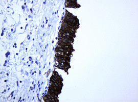 ABCB1 Antibody in Immunohistochemistry (Paraffin) (IHC (P))