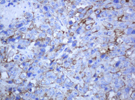 ABCB1 Antibody in Immunohistochemistry (Paraffin) (IHC (P))