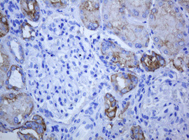 ABCB1 Antibody in Immunohistochemistry (Paraffin) (IHC (P))