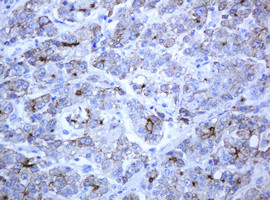 ABCB1 Antibody in Immunohistochemistry (Paraffin) (IHC (P))