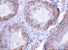 ABCB1 Antibody in Immunohistochemistry (Paraffin) (IHC (P))