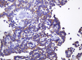 ABCB1 Antibody in Immunohistochemistry (Paraffin) (IHC (P))