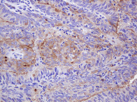 ABCB1 Antibody in Immunohistochemistry (Paraffin) (IHC (P))