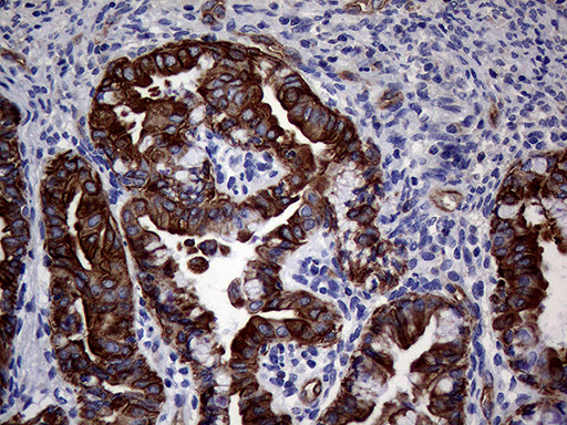 ABCB1 Antibody in Immunohistochemistry (Paraffin) (IHC (P))