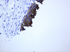 ABCB1 Antibody in Immunohistochemistry (Paraffin) (IHC (P))