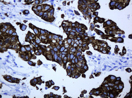 ABCB1 Antibody in Immunohistochemistry (Paraffin) (IHC (P))