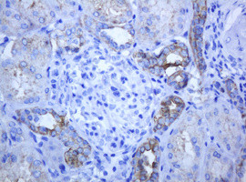 ABCB1 Antibody in Immunohistochemistry (Paraffin) (IHC (P))