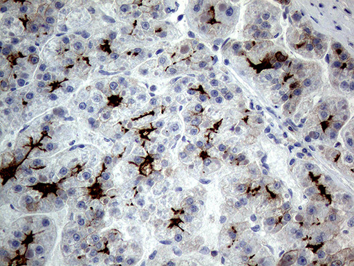 ABCB1 Antibody in Immunohistochemistry (Paraffin) (IHC (P))