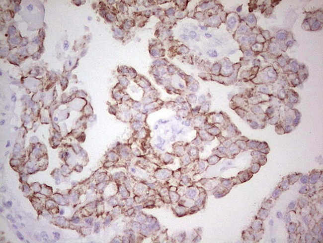 ABCB1 Antibody in Immunohistochemistry (Paraffin) (IHC (P))