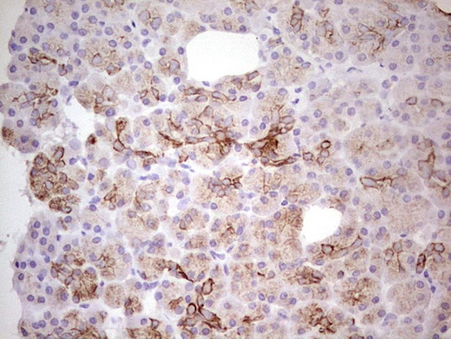 ABCB1 Antibody in Immunohistochemistry (Paraffin) (IHC (P))