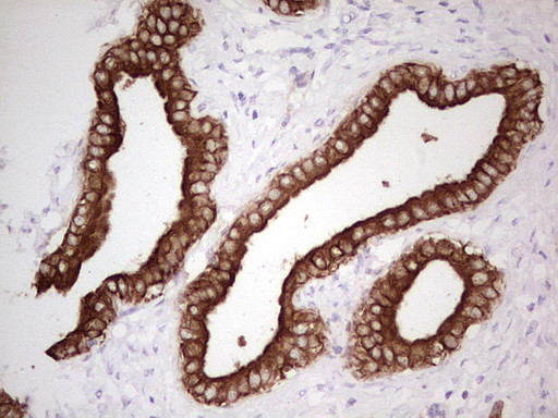 ABCB1 Antibody in Immunohistochemistry (Paraffin) (IHC (P))