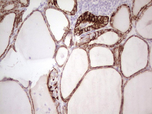 ABCB1 Antibody in Immunohistochemistry (Paraffin) (IHC (P))