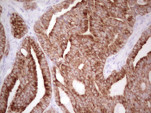 ABCB1 Antibody in Immunohistochemistry (Paraffin) (IHC (P))