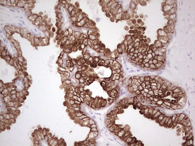 ABCB1 Antibody in Immunohistochemistry (Paraffin) (IHC (P))