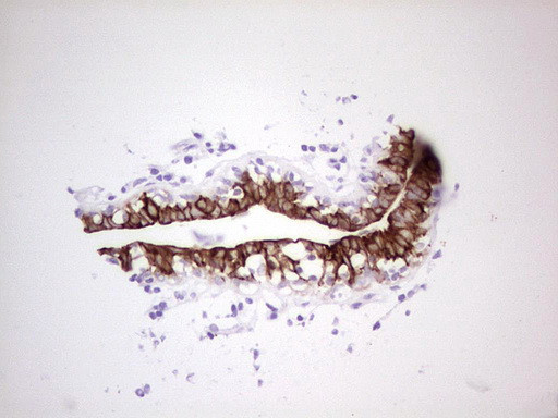 ABCB1 Antibody in Immunohistochemistry (Paraffin) (IHC (P))