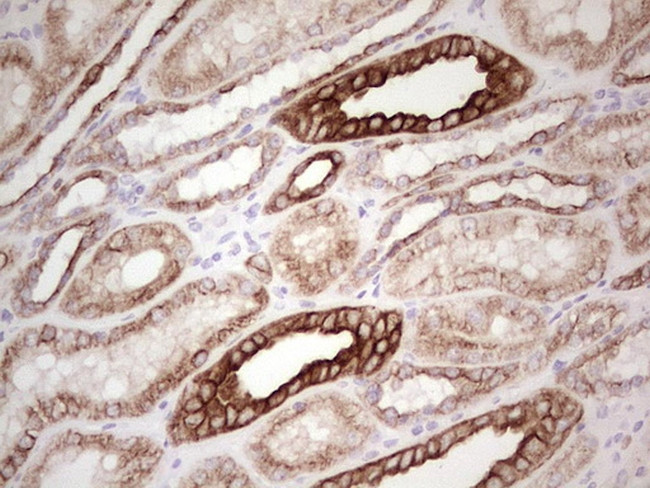 ABCB1 Antibody in Immunohistochemistry (Paraffin) (IHC (P))